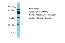 Myotubularin Related Protein 10 Rabbit anti-Human, Polyclonal, Novus Biologicals